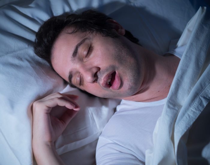 dangers-of-sleep-apnea-mint-dental-dc